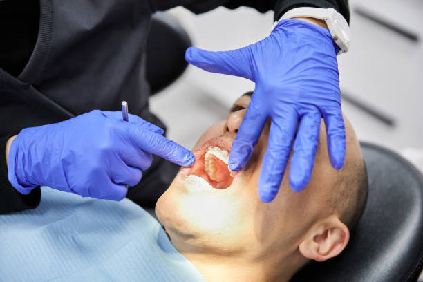 Best Emergency Dental Care for Broken or Chipped Teeth in Drum Point, MD